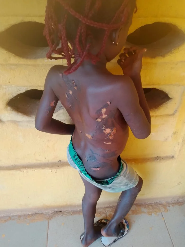 Police Arrest Mother Over Alleged Abuse of Seven-Year-Old Daughter in Anambra